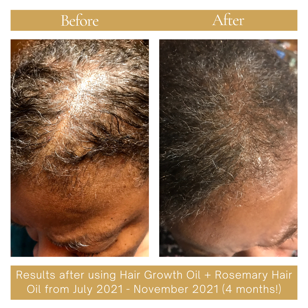 Re-Growth Hair Oil