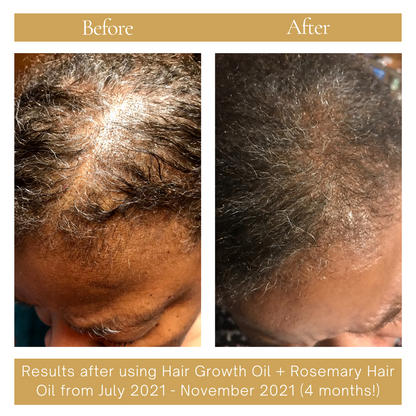 Re-Growth Hair Oil